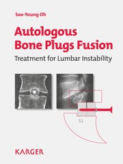 Cover of: Autologous bone plugs fusion: treatment for lumbar instability : 3E criteria, technical operative notes, the functioning of the Oh's screw