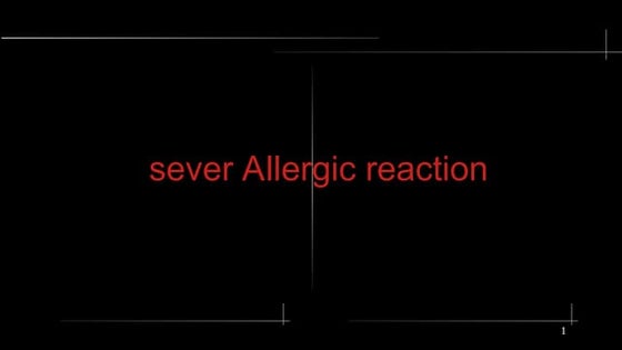 allargic reaction explain in easy way to understand