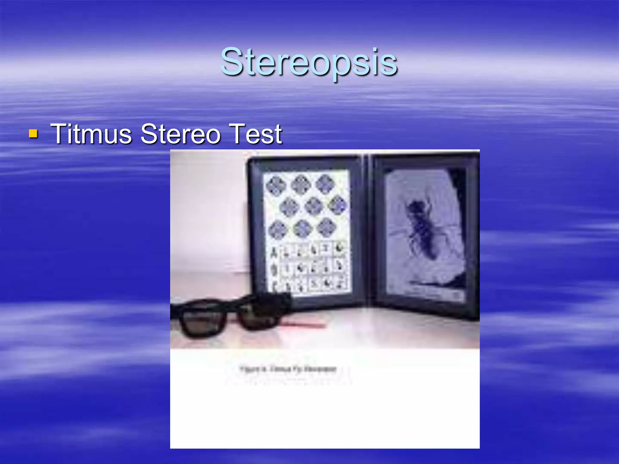 Stereopsis
 Titmus Stereo Test
 