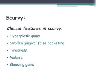 Scurvy:
Clinical features in scurvy:
• Hyperplasic gums
• Swollen gingival false pocketing
• Tiredness
• Malaise
• Bleeding gums
 