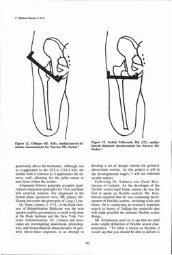 generously above the trochanter. Although, not
as exaggerated as the UCLA CAT-CAM, the
medial wall is lowered as it approac