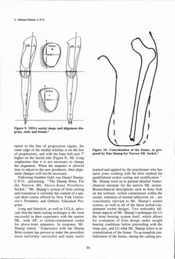 tation to the line of progression (again, the
outer edge of the medial trimline is on the line
of progression), and with th